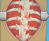play Operate Now Scoliosis Sugery