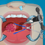 play Tonsil Surgery