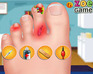 play Zoe Nail Doctor