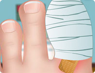 play Zoe Nail Doctor