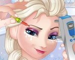 play Elsa Eye Care