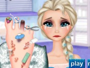play Elsa Foot Doctor