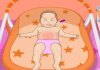 play Baby Stomach Upset