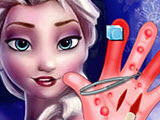 play Elsa Hand Surgery