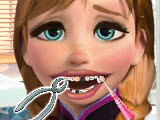 play Anna Frozen At The Dentist