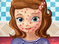 play Squeeze Sofia Pimples