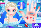 play Doctor Frozen Elsa Hand