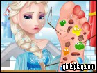 play Elsa Foot Doctor