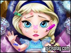 play Baby Elsa Injured