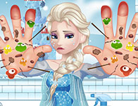 play Elsa Hand Doctor