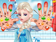 play Elsa Hand Doctor