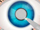 Operate Now: Eye Surgery