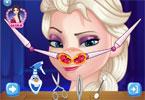 play Elsa Nose Problems