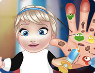 play Baby Elsa Hand Doctor