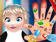 play Baby Elsa Hand Doctor