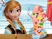 play Anna Foot Doctor