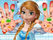 play Anna Hand Doctor