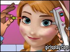 play Anna Eye Doctor