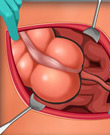 Appendix Surgery game