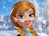 play Anna Nose Problems