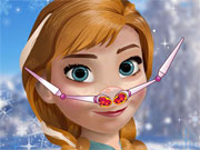 Anna Nose Problems