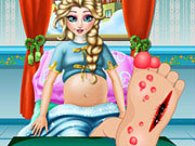 play Pregnant Elsa Foot Check-Up