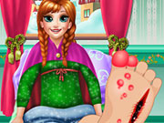 play Anna Foot Check-Up
