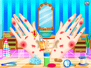 play Princess Hand Doctor