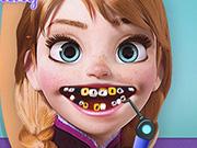 play Anna Frozen Dentist 2