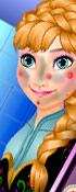 play Anna Skin Treatment