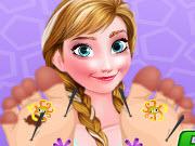 play Frozen Anna Foot Doctor