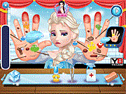 play Elsa Hand Treatment