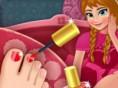 play Anna'S Pedicure