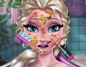 play Elsa Skin Doctor