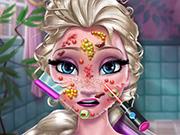 play Elsa Skin Doctor