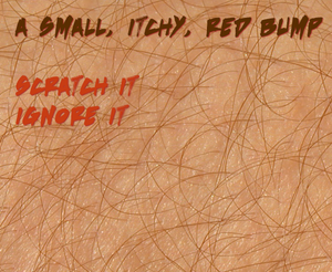 play Itch