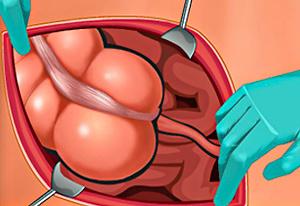 play Appendix Surgery