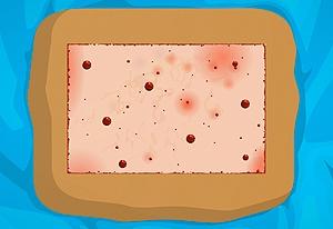 play Operate Now: Skin Surgery
