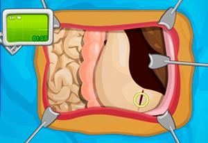 play Operate Now: Stomach Surgery