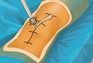 play Virtual Knee Surgery