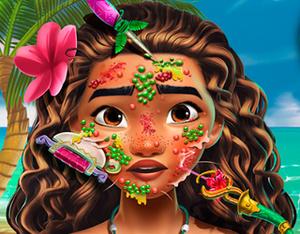 play Moana Skin Doctor