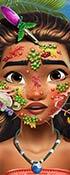 play Moana Skin Doctor
