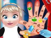 play Baby Elsa Hand Doctor