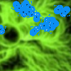 Coronavirus Vs. World