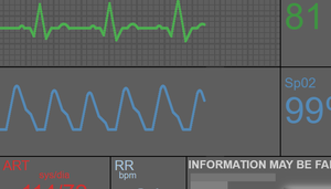 play Physiological Monitor Simulator