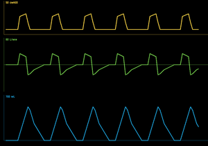 play Vent (Beta)