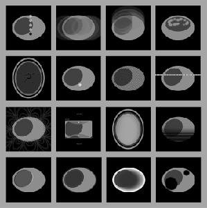 play Mri Artifact Quiz