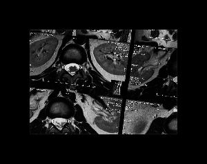 play Nihilist Syndrome